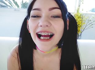 Sex Starved Nympho With Braces Longing For Huge Throbber