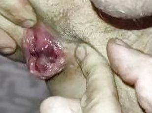 Anal gape And fingering